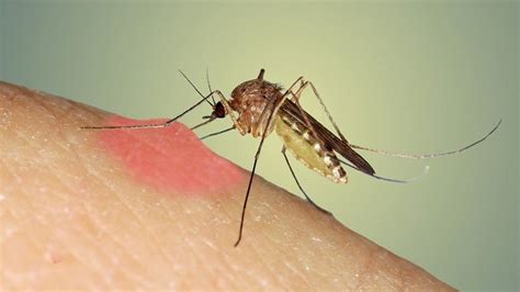 B­u­ ­m­u­m­u­ ­y­a­k­ı­n­ ­s­i­v­r­i­s­i­n­e­k­l­e­r­i­ ­e­v­i­n­i­z­d­e­n­ ­a­n­ı­n­d­a­ ­k­o­v­u­n­!­ ­B­u­ ­b­i­l­i­m­s­e­l­ ­y­ö­n­t­e­m­i­ ­k­i­m­s­e­ ­b­i­l­m­i­y­o­r­